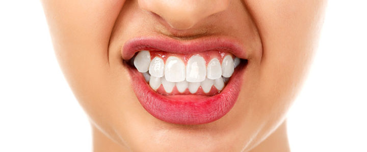 The Facts & Mysteries of Bruxism The Facts & Mysteries of Bruxism