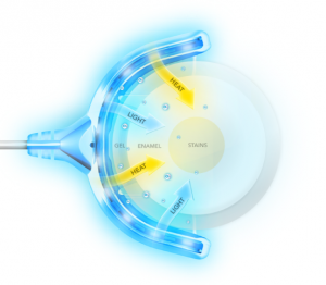 GLO teeth whitening mouthpiece technology